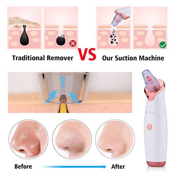 image-Electric Skin blackhead Vacuum Facial Blackhead Remover