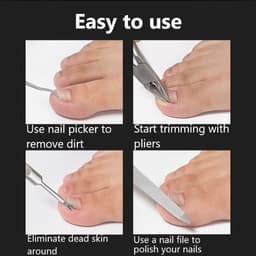 image-Toe Nail Clippers Nail Correction Thick Nails Ingrown Toenails Nippers