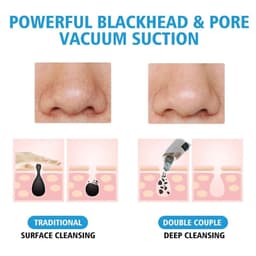 image-Electric Facial Blackhead Remover Vacuum Acne Spots Pore Black Dot