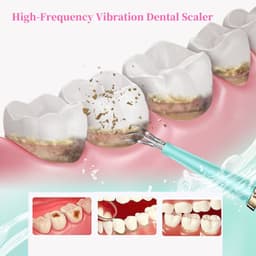 image-Portable Electric Sonic Dental Scaler Tooth Cleanser Dentist Calculus
