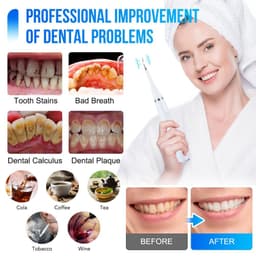 image-Newest Electric Toothbrushes Dental Scaler for Adults USB Charging