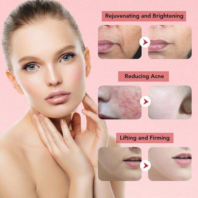 image-7 In 1 RF Face Massager Skin Rejuvenation Mesotherapy Facial Lifting