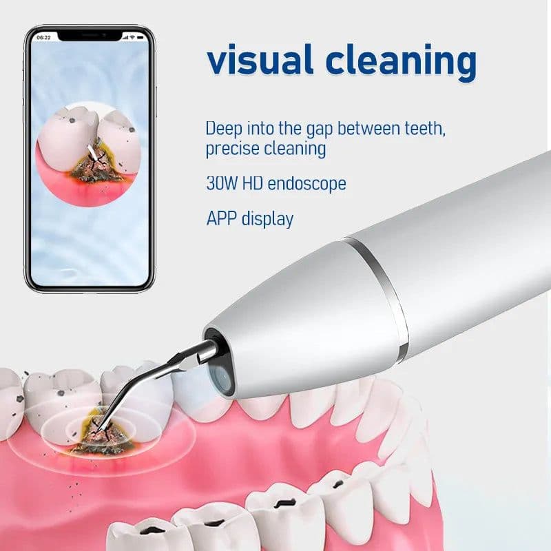 image-Ultrasonic Dental Scaler Electric Teeth Cleaner for Tooth Whitening