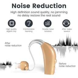 image-Portable Rechargeable Hearing Aid Sound Amplifier Magnetic Charging