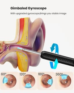 image-Ear Wax Removal Tool-Spade Ear Cleaner with Ear Camera1296P Ear-Scope