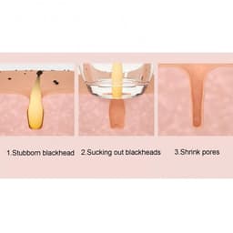 image-Blackhead Remover Pore Vacuum Cleaner Face Skin Care Sucker