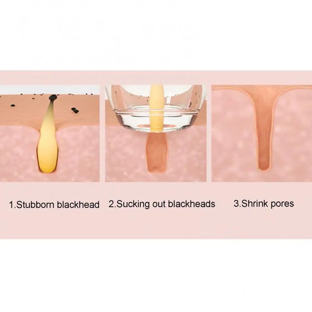 image-Blackhead Remover Pore Vacuum Cleaner Face Skin Care Sucker