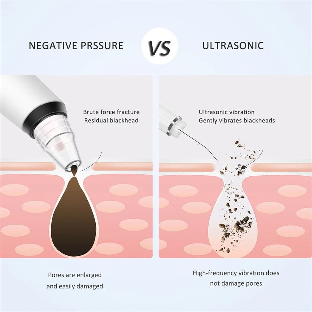 image-Ultrasonic Skin Scrubber EMS Vibration Ion Acne Pore Blackhead Remover