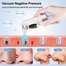 image-Electric Blackhead Remover Pore Vacuum Cleaner Facial Black Dots