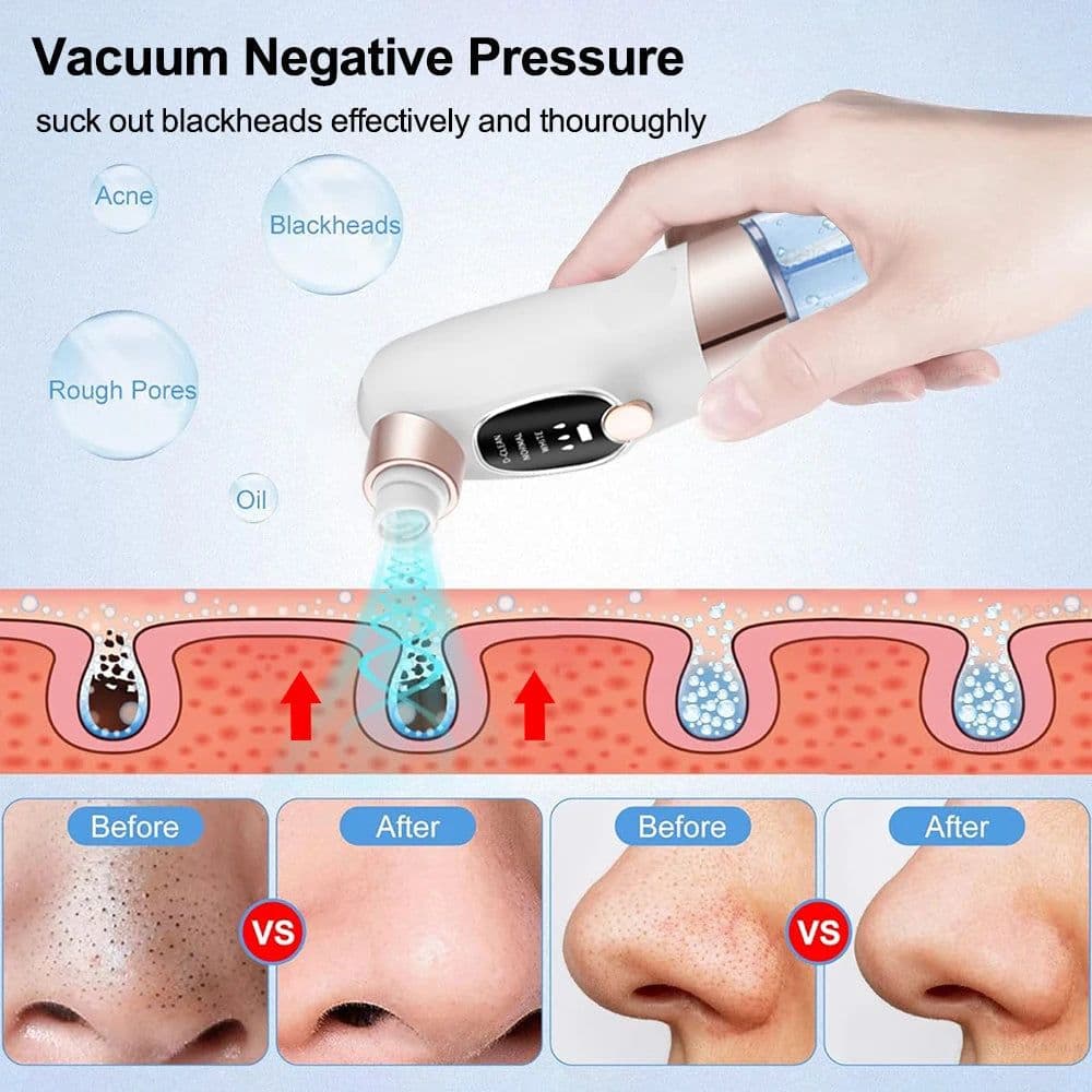 image-Electric Blackhead Remover Pore Vacuum Cleaner Facial Black Dots