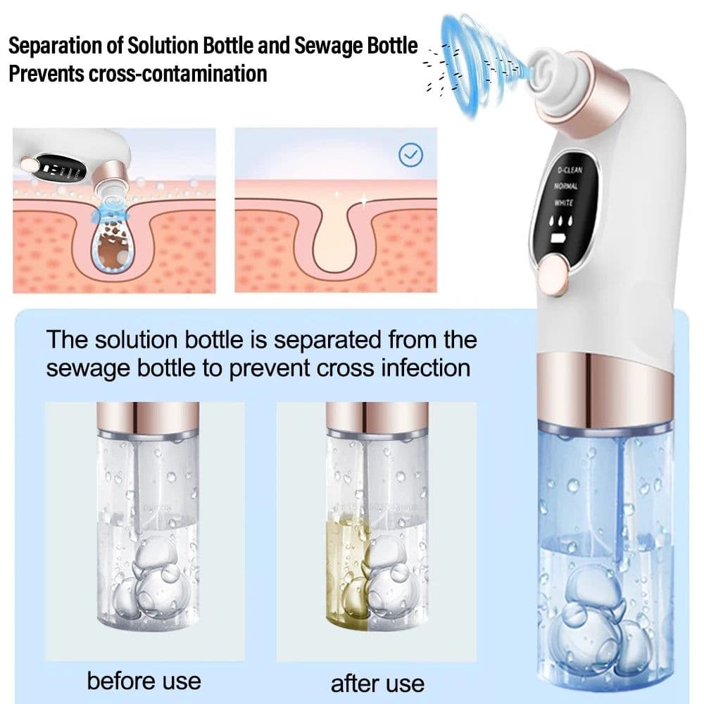 image-Electric Blackhead Remover Pore Vacuum Cleaner Facial Black Dots