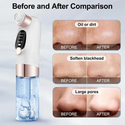 image-Electric Blackhead Remover Pore Vacuum Cleaner Facial Black Dots