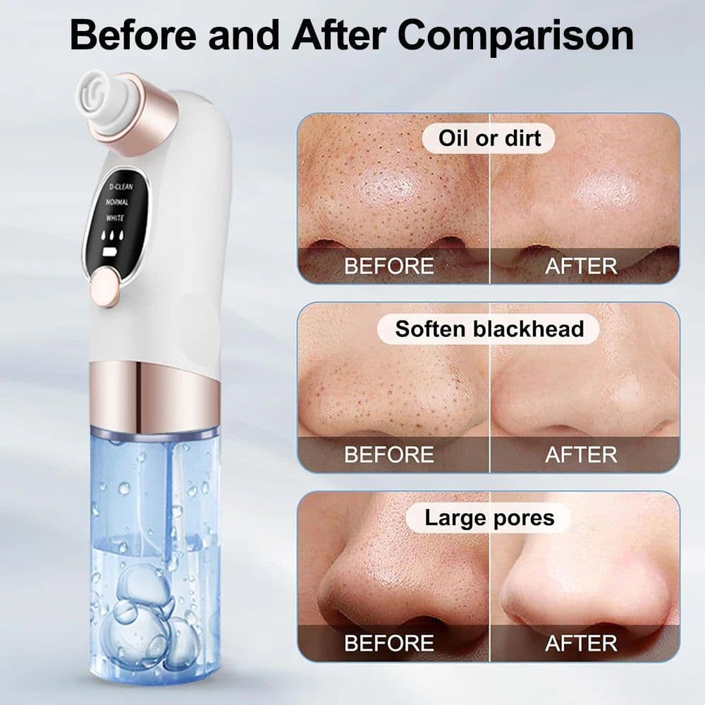 image-Electric Blackhead Remover Pore Vacuum Cleaner Facial Black Dots