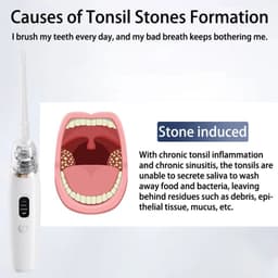 image-Electric Tonsil Stone Remover Tonsil Stone Removal Kit Vacuum