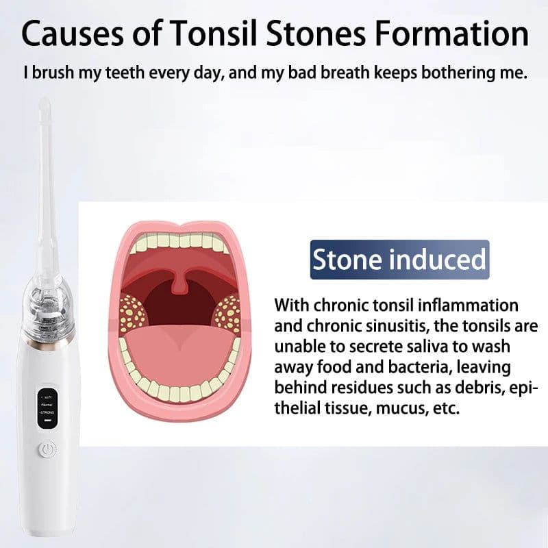 image-Electric Tonsil Stone Remover Tonsil Stone Removal Kit Vacuum