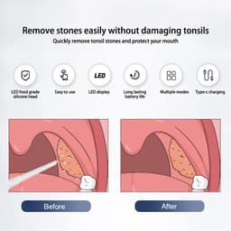 image-Electric Tonsil Stone Remover Tonsil Stone Removal Kit Vacuum