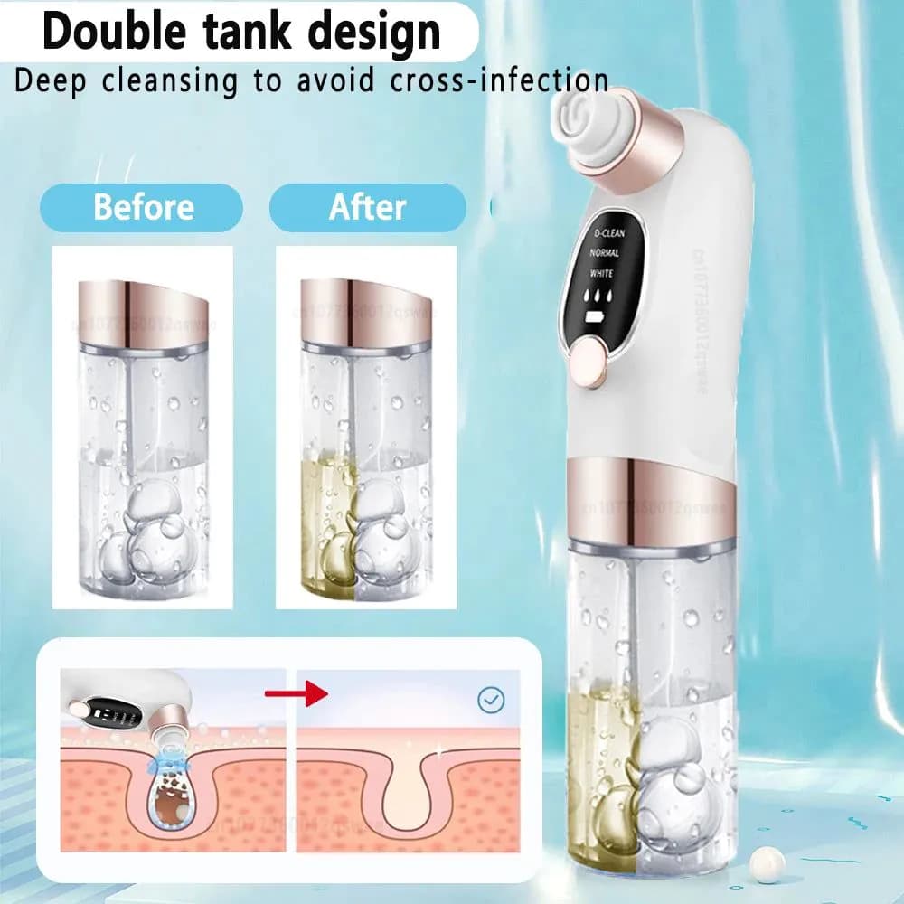 image-Blackhead Remover Pore Vacuum Face Nose Deep Cleaning Electric Pimple