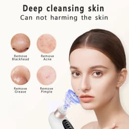 image-Blackhead Remover Pore Vacuum Face Nose Deep Cleaning Electric Pimple