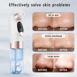 image-Blackhead Remover Pore Vacuum Face Nose Deep Cleaning Electric Pimple