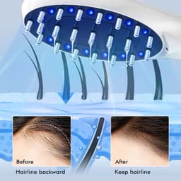 image-Electric Infrared Massage Comb Hair Growth 5V Electric Vibration Head