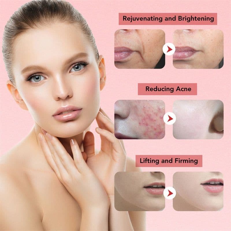 image-EMS Facial Massager LED Light Anti Aging Wrinkle Facial Care