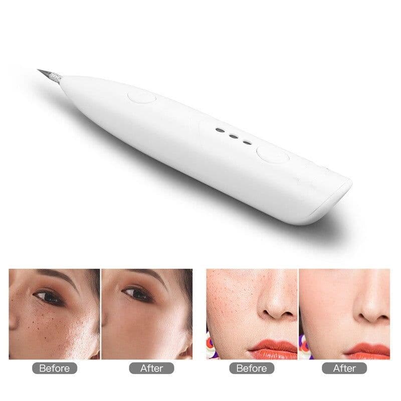 image-Electric Mini Laser Pen Tattoo Mole Removal Machine Face Care Skin Tag
