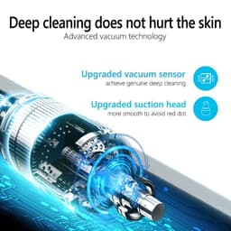 image-Facial Blackhead Remover Electric Acne Cleaner Device