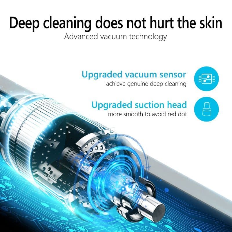 image-Facial Blackhead Remover Electric Acne Cleaner Device