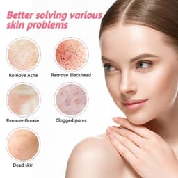 image-Facial Blackhead Remover Electric Acne Cleaner Device