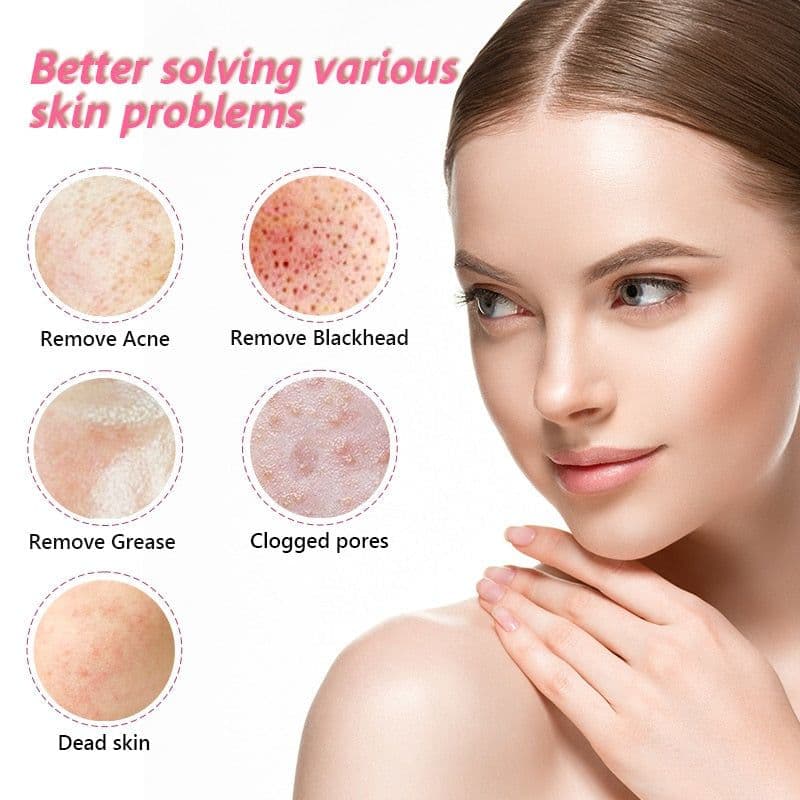 image-Facial Blackhead Remover Electric Acne Cleaner Device