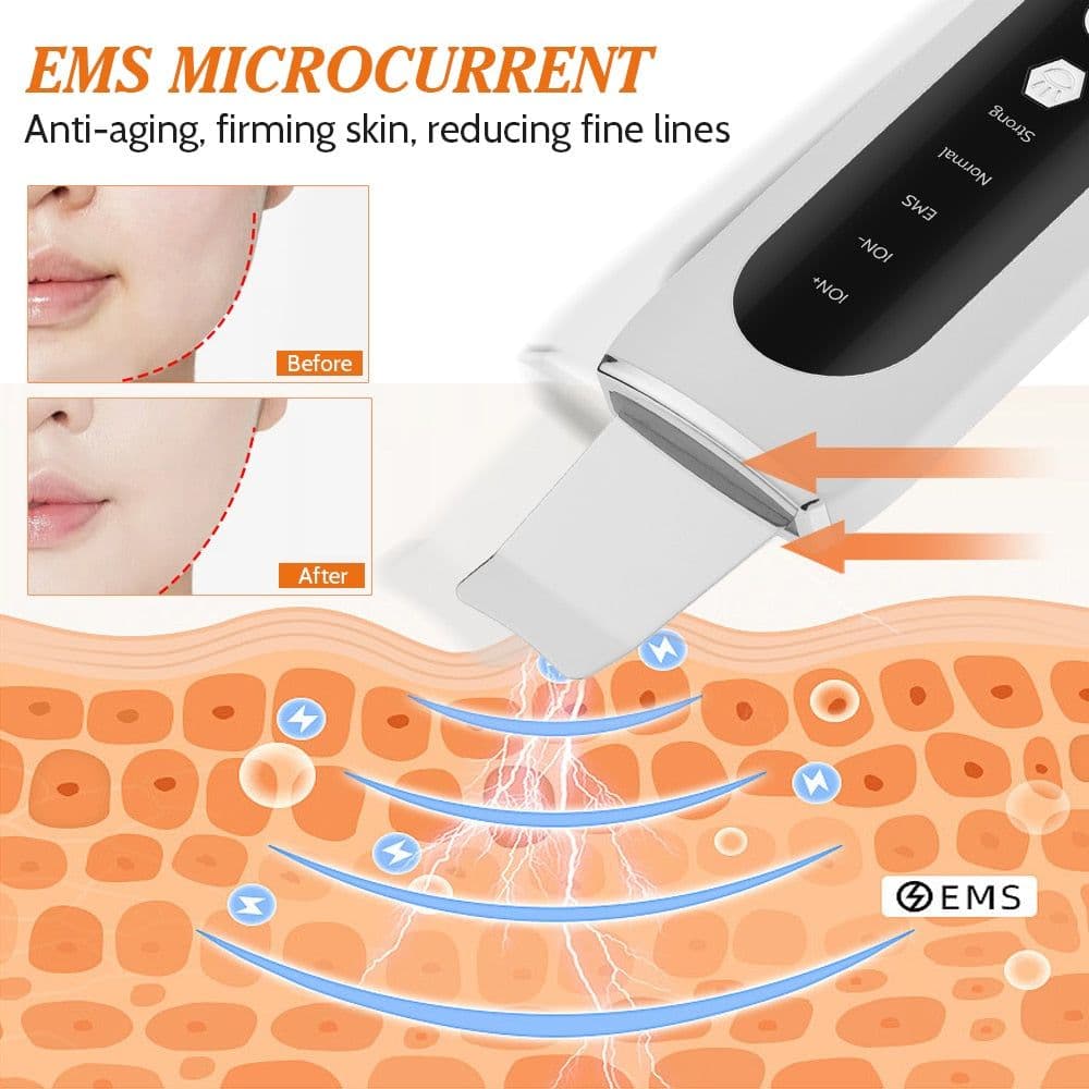 image-Ultrasonic Skin Scrubber EMS Microcurrent Face Lifting