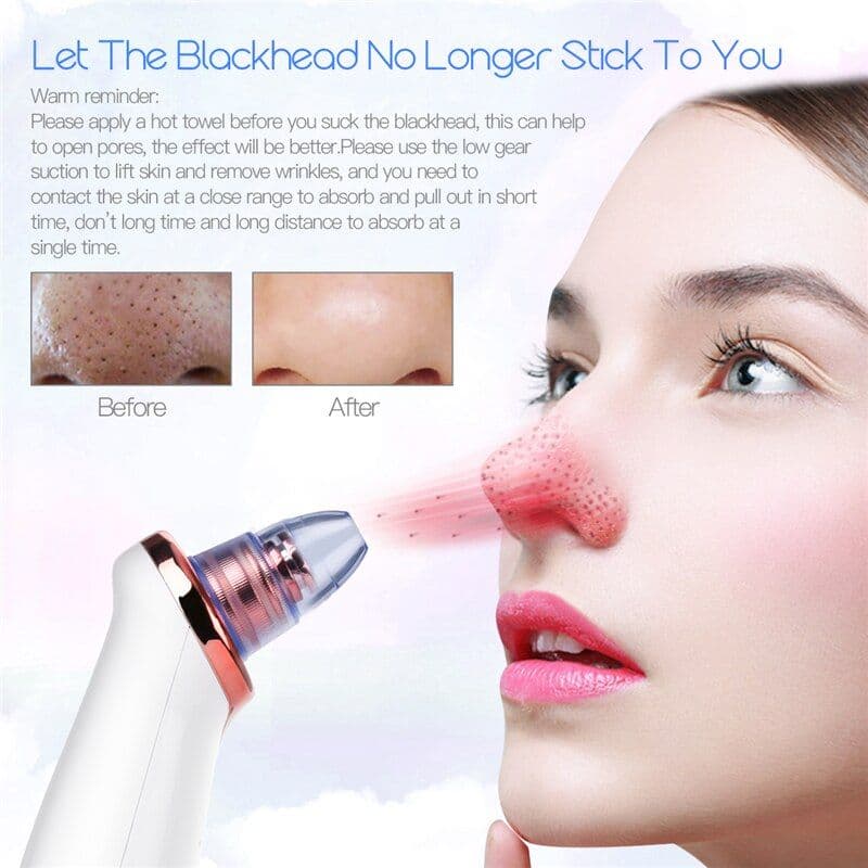 image-Vacuum Blackhead Remover Pimple Acne Removal Tool Skin Care Pore