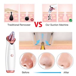 image-Vacuum Blackhead Remover Pimple Acne Removal Tool Skin Care Pore
