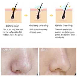image-Electric cleanser Facial Cleansing Brush Face Skin Care Tools