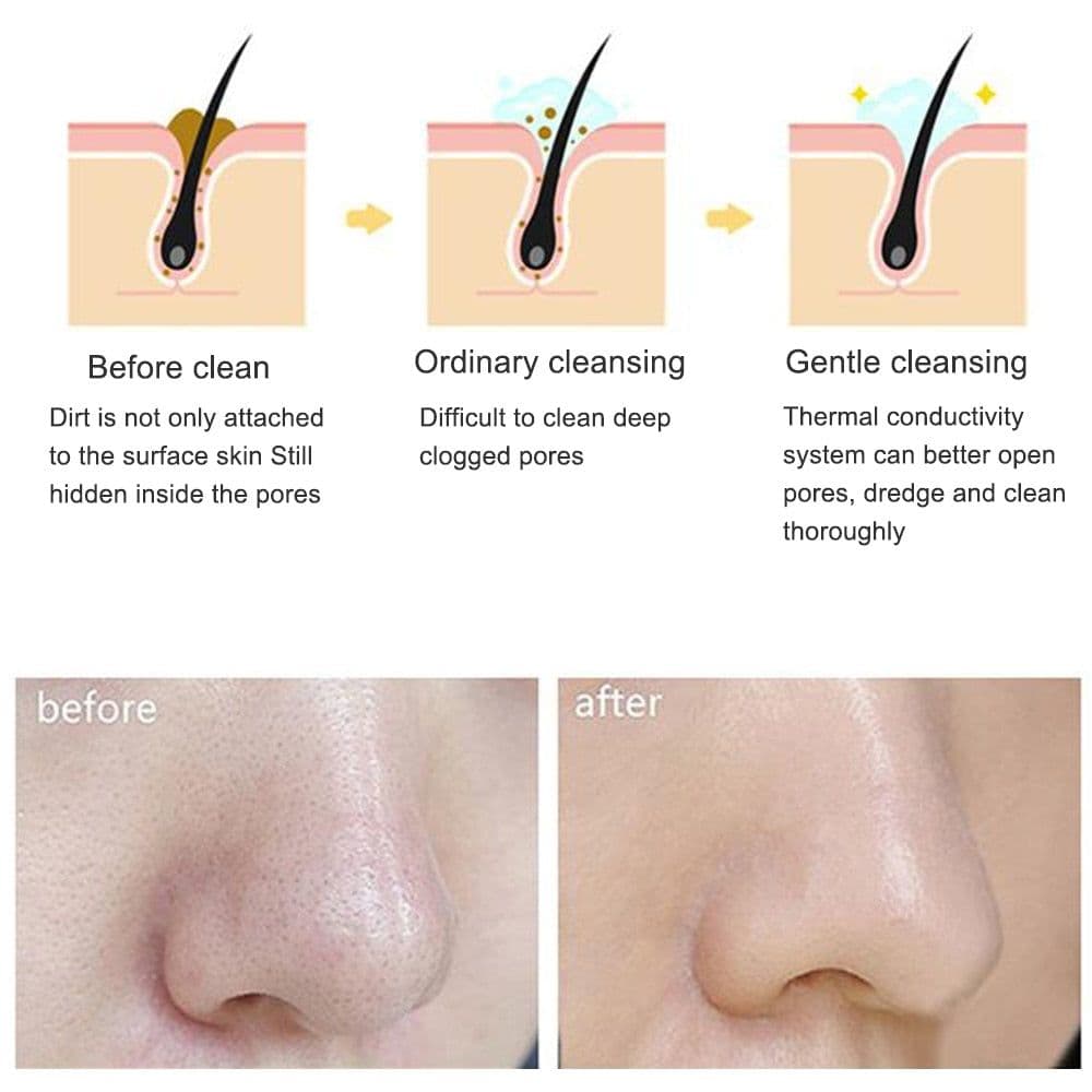 image-Electric cleanser Facial Cleansing Brush Face Skin Care Tools