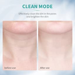 image-3 Colors Led Facial Neck Massager Photon Skin Tighten Slimming Reduce
