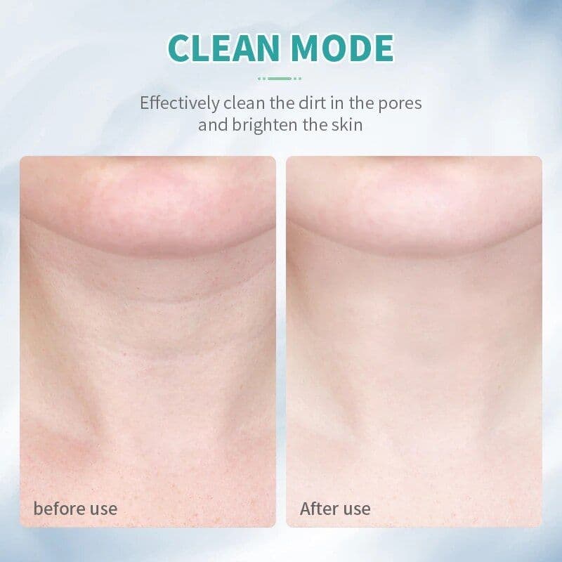 image-3 Colors Led Facial Neck Massager Photon Skin Tighten Slimming Reduce