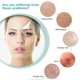 image-4 in 1 Electric Facial Cleanser Wash Face Cleaning Machine Skin Pore