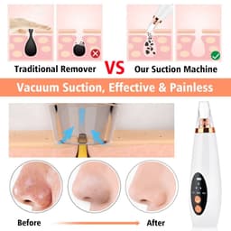image-Facial Pore Cleaner Blackhead Remover Vacuum Suction Cleaner