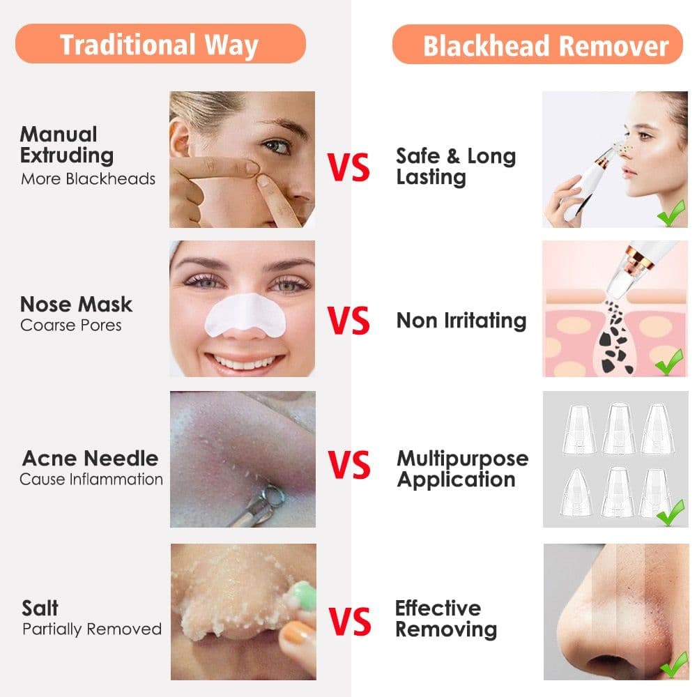 image-Facial Pore Cleaner Blackhead Remover Vacuum Suction Cleaner