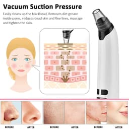 image-Blackhead Remover Electric Facial Cleansing Pore Vacuum Cleaner Ance