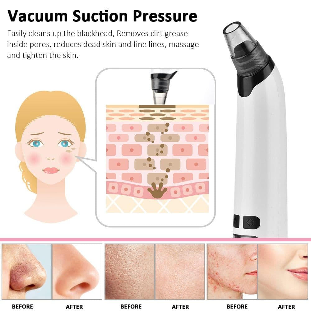 image-Blackhead Remover Electric Facial Cleansing Pore Vacuum Cleaner Ance