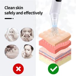 image-Blackhead Remover Face Nose Deep Cleaner Pore Acne Pimple Removal