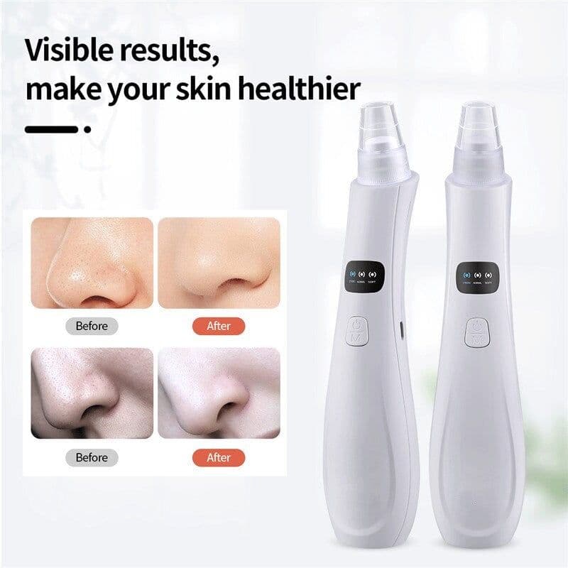 image-Blackhead Remover Face Nose Deep Cleaner Pore Acne Pimple Removal