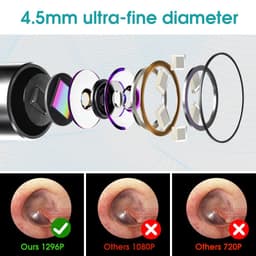 image-4.5mm Ear Cleaner Otoscope Ear Wax Cleaning Tool Endoscope Ear Pick