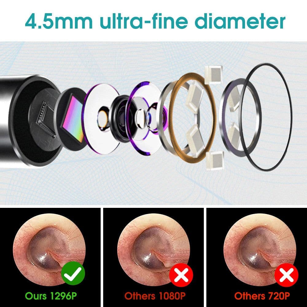 image-4.5mm Ear Cleaner Otoscope Ear Wax Cleaning Tool Endoscope Ear Pick