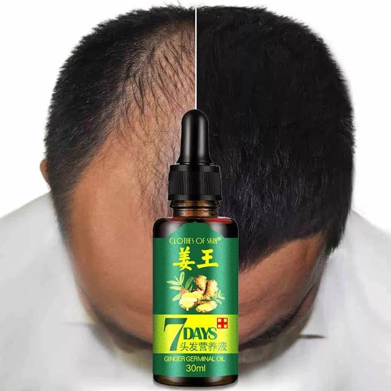 image-Factory direct skin clothing ginger king hair nutrition liquid spot ginger Wang Sheng liquid can be authorized spot genuine