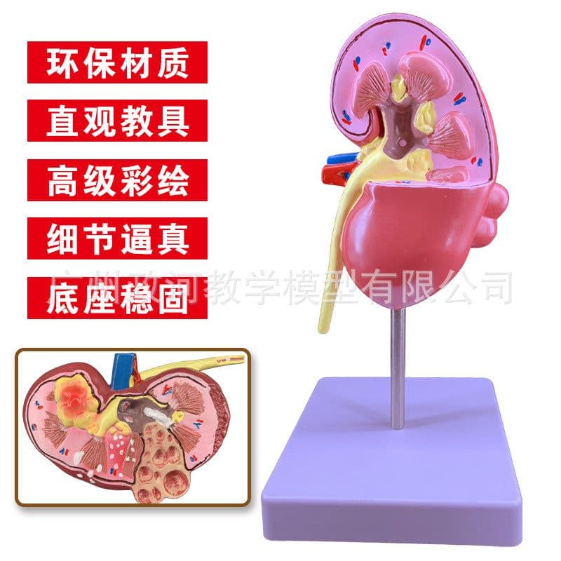 image-Diseased Kidney Model - PVC Anatomy Teaching Aid