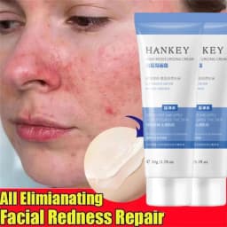 image-Facial Redness Repair Cream - Sensitive Skin Moisturizer