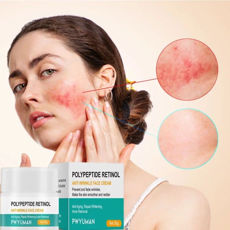 image-Facial Redness Repair Cream - Sensitive Skin Moisturizer